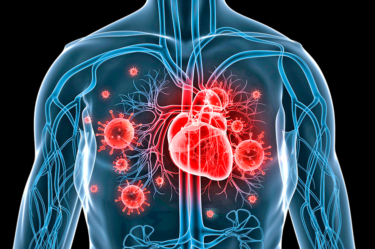 Ateneo de Cardiología - Caso clínico: Endocarditis infecciosa en TAVI