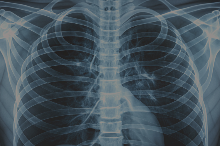 Dolor torácico de etiología incierta. Un desafío en la práctica médica.