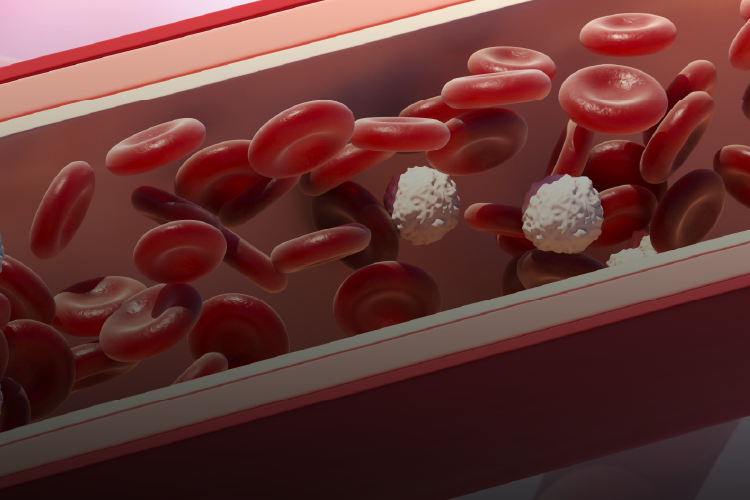 Nacimiento anómalo de arterias coronarias